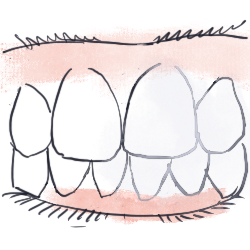 blanchiment